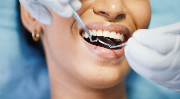 Best Emergency Root Canal Treatment in Lebanon, VA